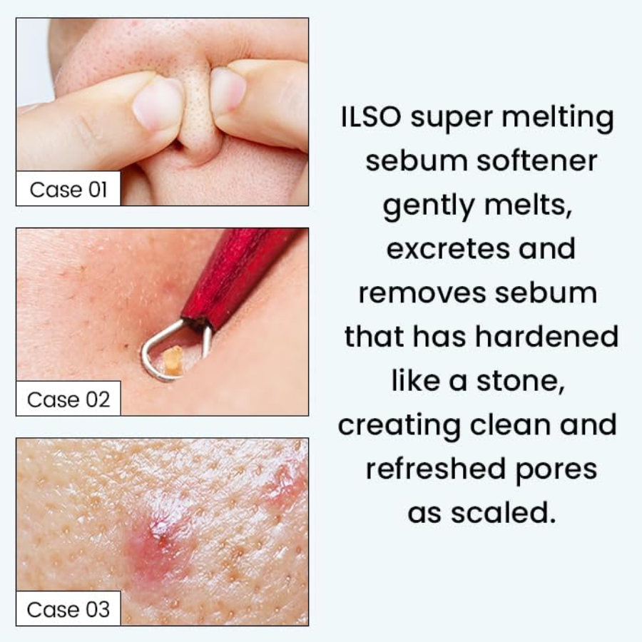[ILSO] Super Melting Sebum Softener 150ml