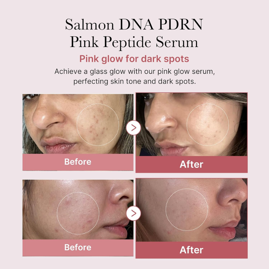 [MEDICUBE] PDRN Pink One Day Serum Set 10 pzs de 1.5 ml c/u