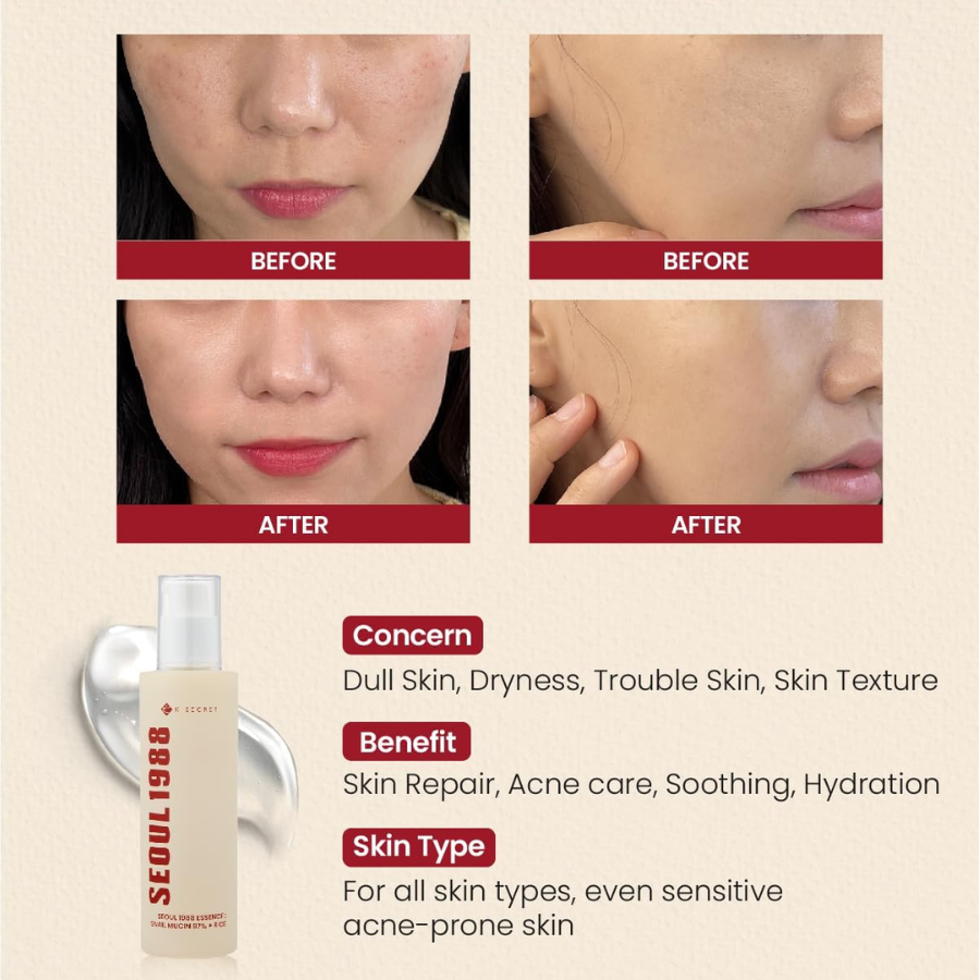 [K-SECRET] SEOUL 1988 Essence : Snail Mucin 97% + Rice 100ml