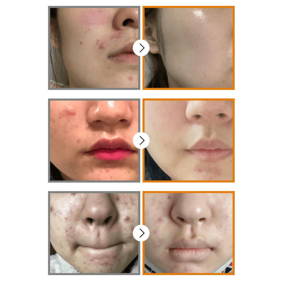 [NUMBUZIN] No.5 Goodbye Blemish Serum 50ml