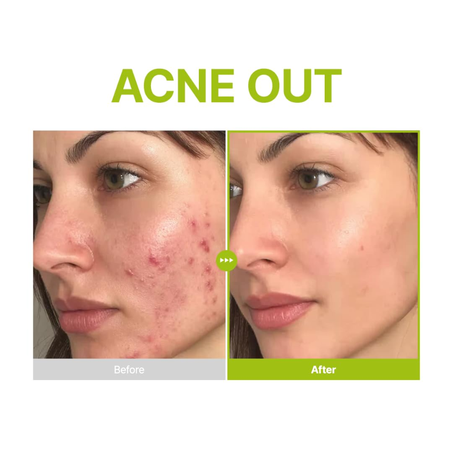 [PURITO] Azelaic Acid 10 Kojic Azulene Serum 30ml