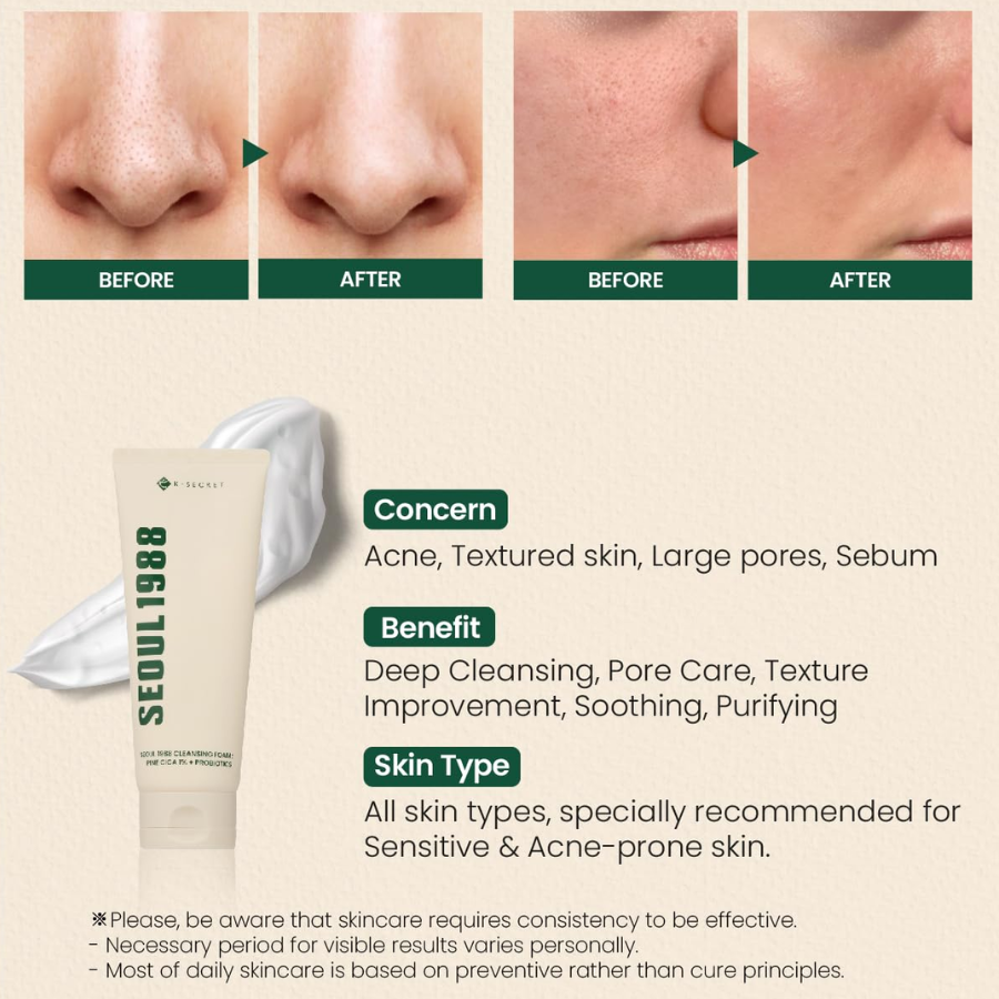 [K-SECRET] SEOUL 1988 Cleansing Foam : Pine Cica 1% + Probiotics