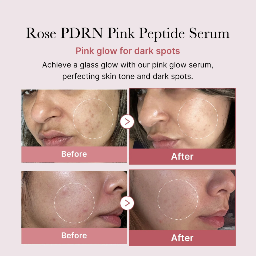 [MEDICUBE] PDRN Pink Peptide Serum 30ml