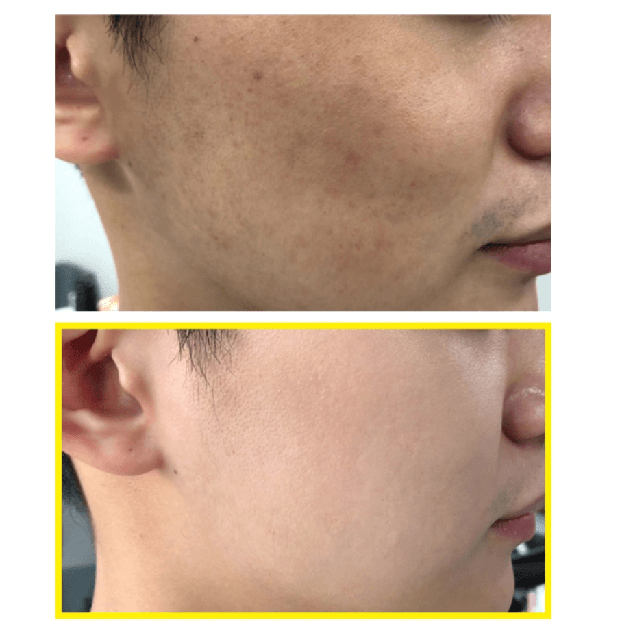 [SOME BY MI] Yuja Niacin Brightening Toner 150ML