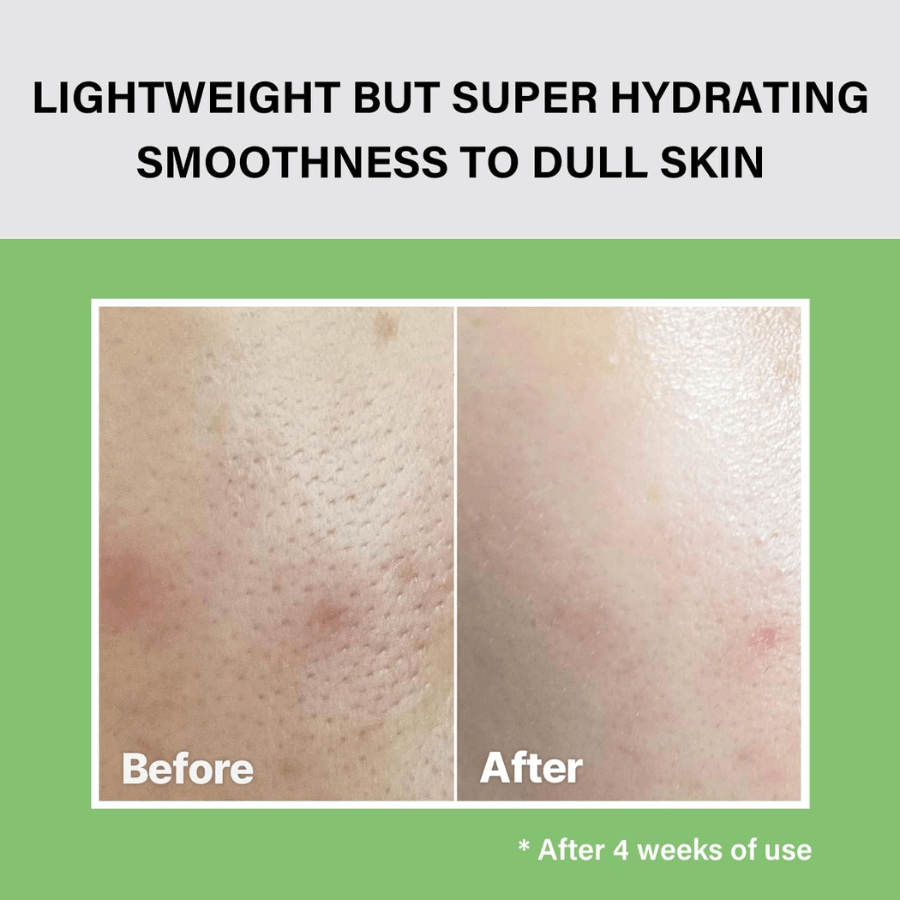 [celimax] Noni Moisture Balancing Toner 150ml