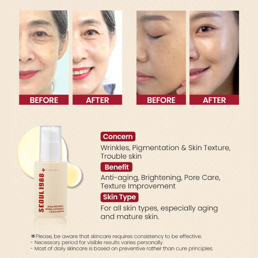 [K-SECRET] SEOUL 1988 Serum: Retinal Liposome 2% + Black Ginseng 30ml