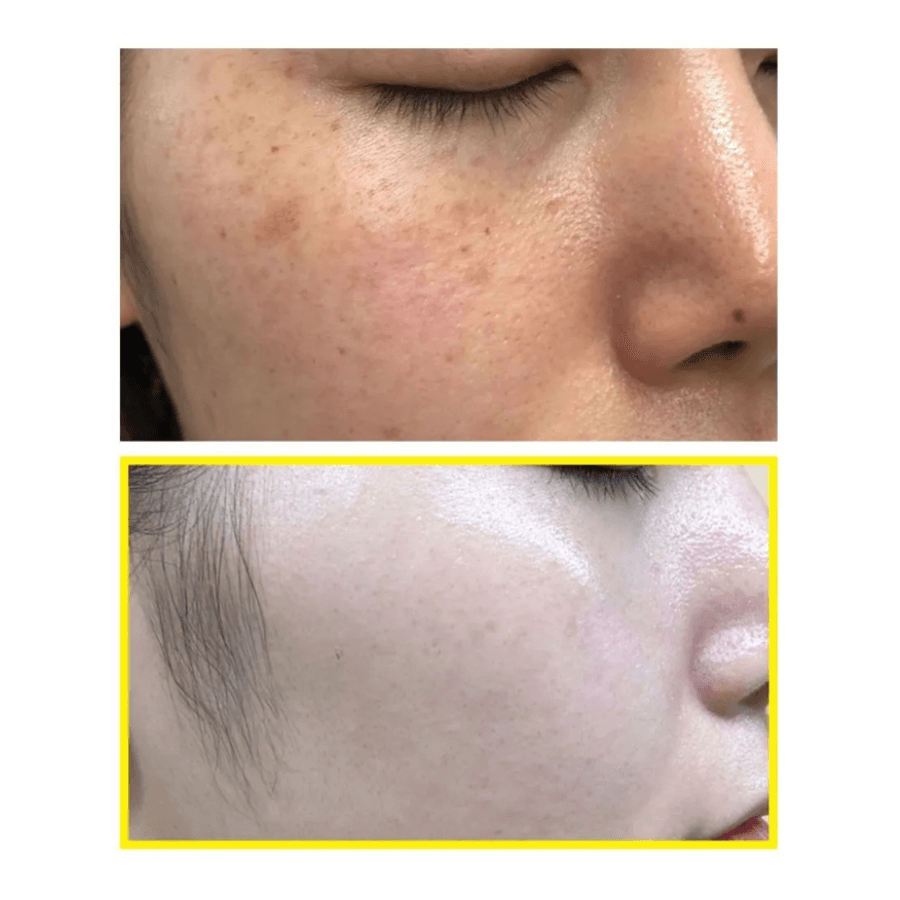 [SOME BY MI] Yuja Niacin Brightening Moisture Gel Cream 100ml