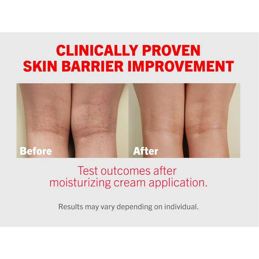 [ATOPALM] MLE Cream 5 piezas de 8ml c/u