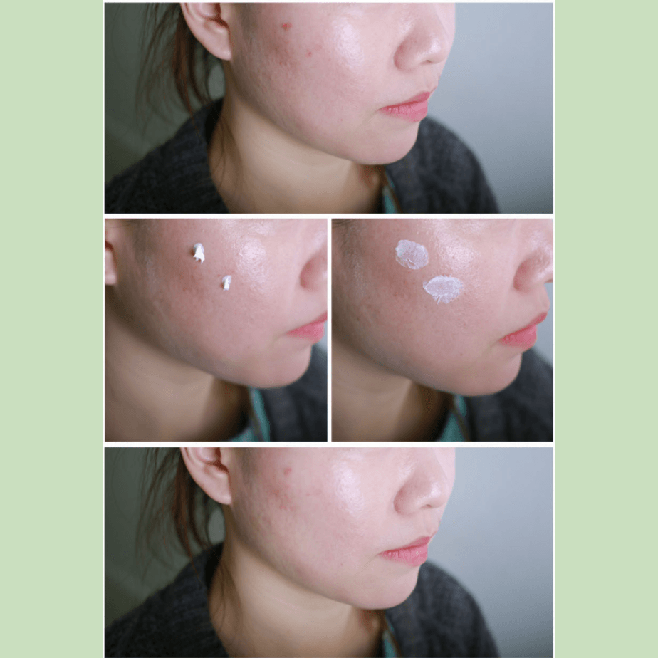 [COSRX] Centella Blemish Cream 30ml