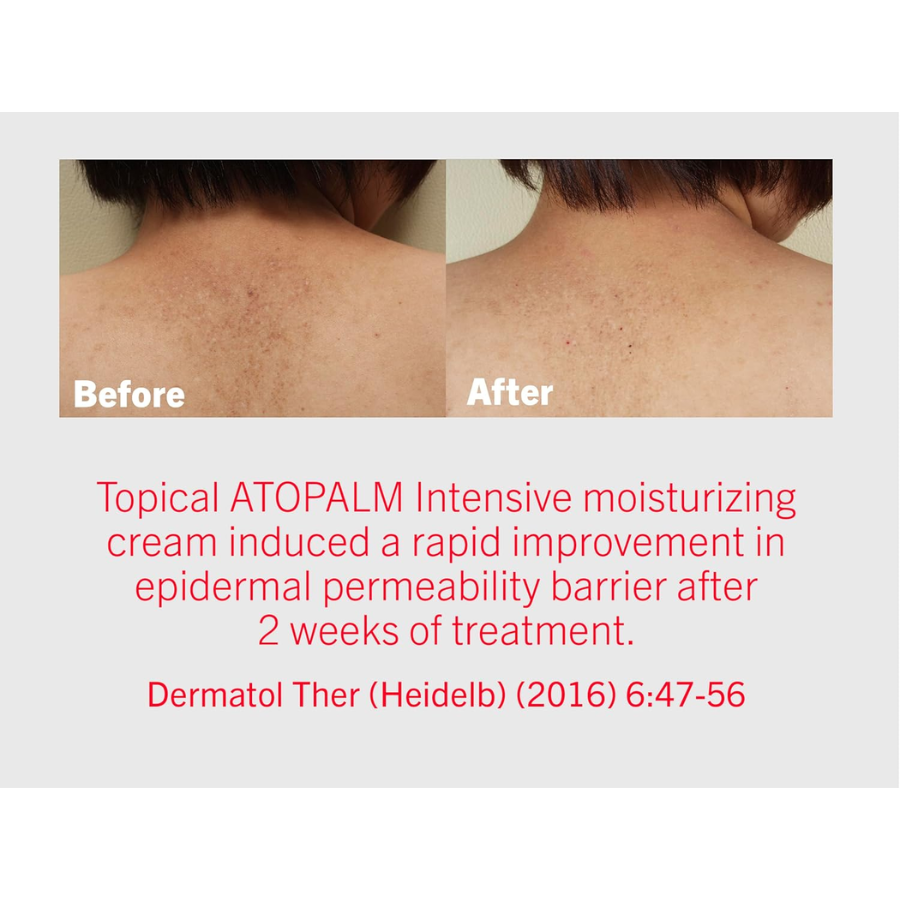 [ATOPALM] MLE Cream 3 piezas de 8 ml c/u