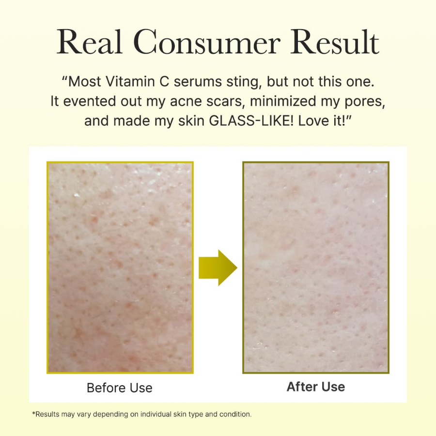 [Arencia] Vitamin C Booster Shot 30ml