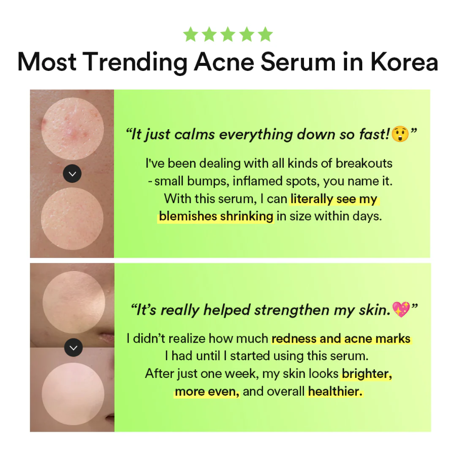 [ABIB] Heartleaf TECA Capsule Serum Calming Drop 50ml