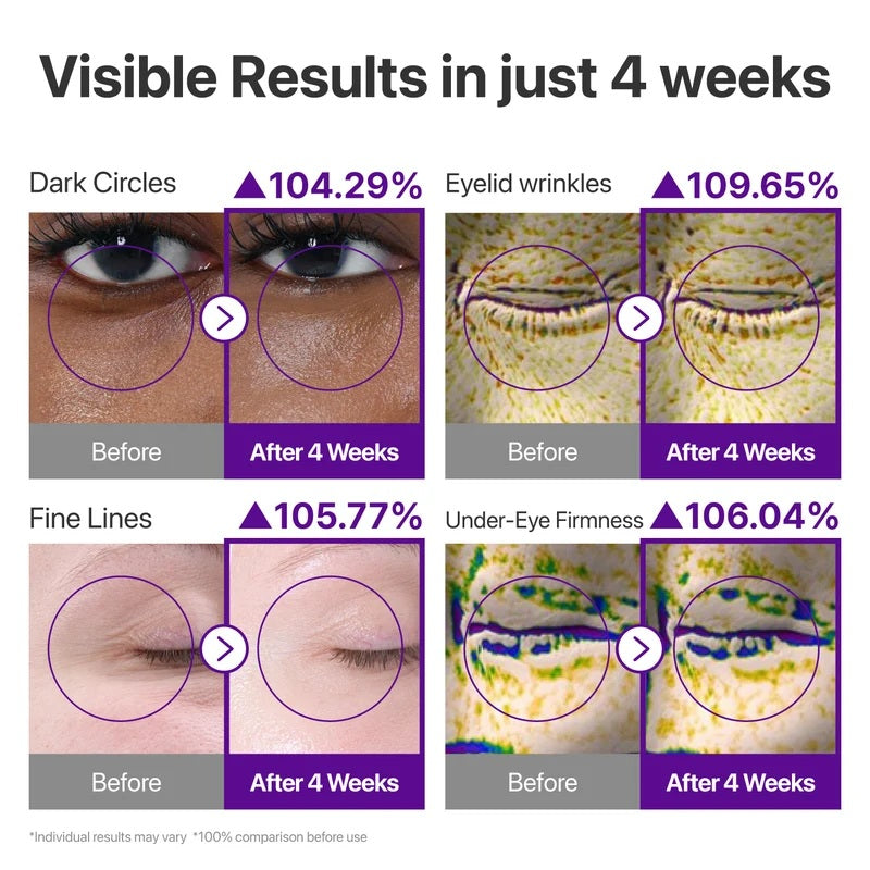 [NUMBUZIN] No.9 NAD Retinol Volumetox Eye Cream 10ml